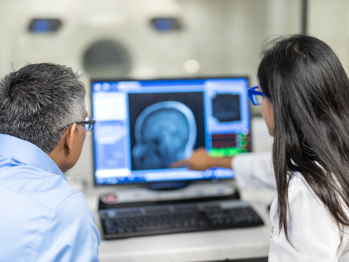 newsweek.com - Jasmine Laws - Everyday foods linked to hidden signs of brain damage‌