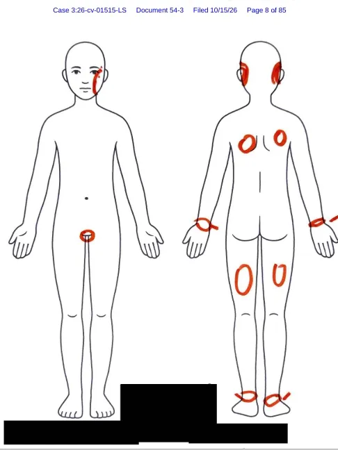 Court documents contain an anatomical diagram on which Isaac marked areas where he said guards injured him.