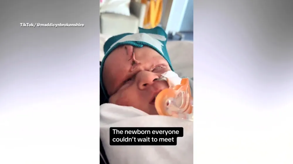 My Son Has a Rare Condition. I Don’t Regret Declining an Abortion ...